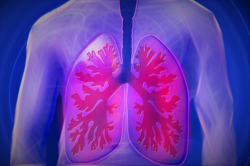 肺管癌患者的生存期限，多方面因素共同影响的结果