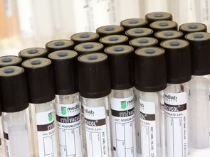 PD-1肺癌患者什么条件可以用？医生手把手教你判断适用性
