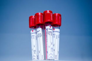 泡性角结膜炎用药指南，了解症状、选择药物与真实案例