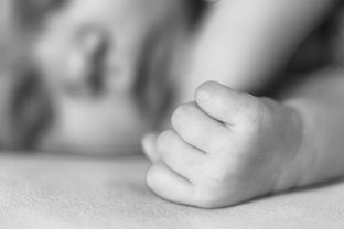 三岁小孩斜视应注意什么