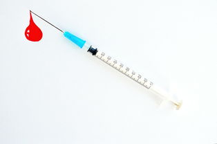 武汉同济医院ICL晶体移植手术费用详解