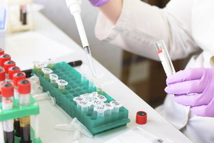 6岁孩子散光怎么办？医生教你科学应对，附案例和注意事项