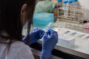 眼角膜烧伤后混浊怎么办？医生教你科学应对
