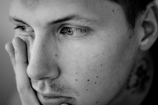 左眼斜视别慌张！成年人如何科学应对斜视问题？