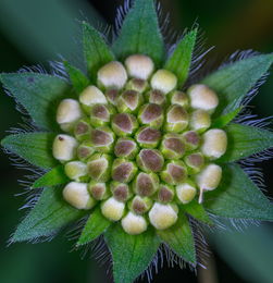 糖尿病植物性病变治疗详解