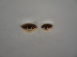 眼睛为什么会白内涨？