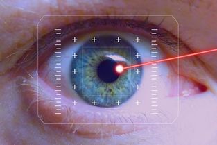 温州眼视光，飞秒激光眼科手术的全新体验