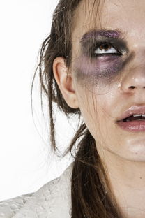 多少人入伍做过近视眼手术？深度解析与实例剖析