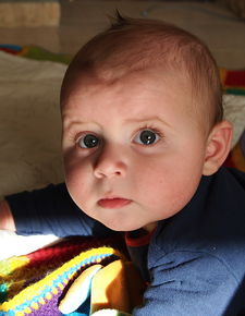 孩子斜视应该如何锻炼？